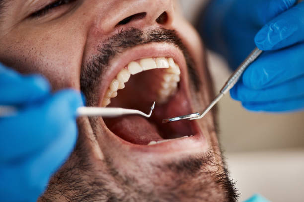Best Emergency Dental Care for Broken or Chipped Teeth in Ferriday, LA
